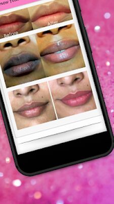 Скачать Lips Care - 13 Home Remedies To Get Soft Pink Lips [Unlocked] RU apk на Андроид