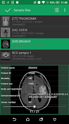 Скачать DroidRender - 3D DICOM viewer [Unlocked] RU apk на Андроид