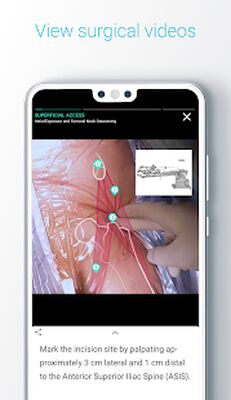 Скачать Touch Surgery: Surgical Videos [Полная версия] RUS apk на Андроид
