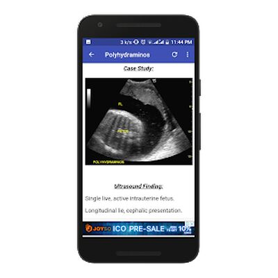 Скачать Obstetrics & Gyenacology Ultrasound Guide [Полная версия] RU apk на Андроид