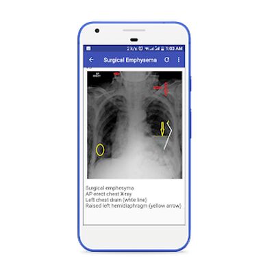 Скачать X-Ray Interpretation Guide [Полная версия] RUS apk на Андроид