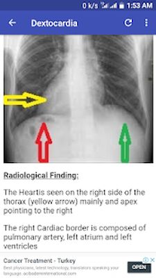 Скачать X-Ray Interpretation Guide [Полная версия] RUS apk на Андроид