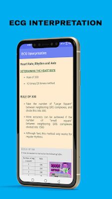 Скачать ECG Interpretation Guide [Полная версия] RUS apk на Андроид
